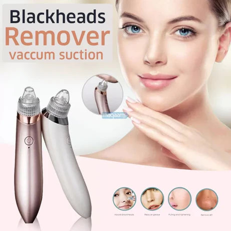 ModeX Blackhead removal Machine