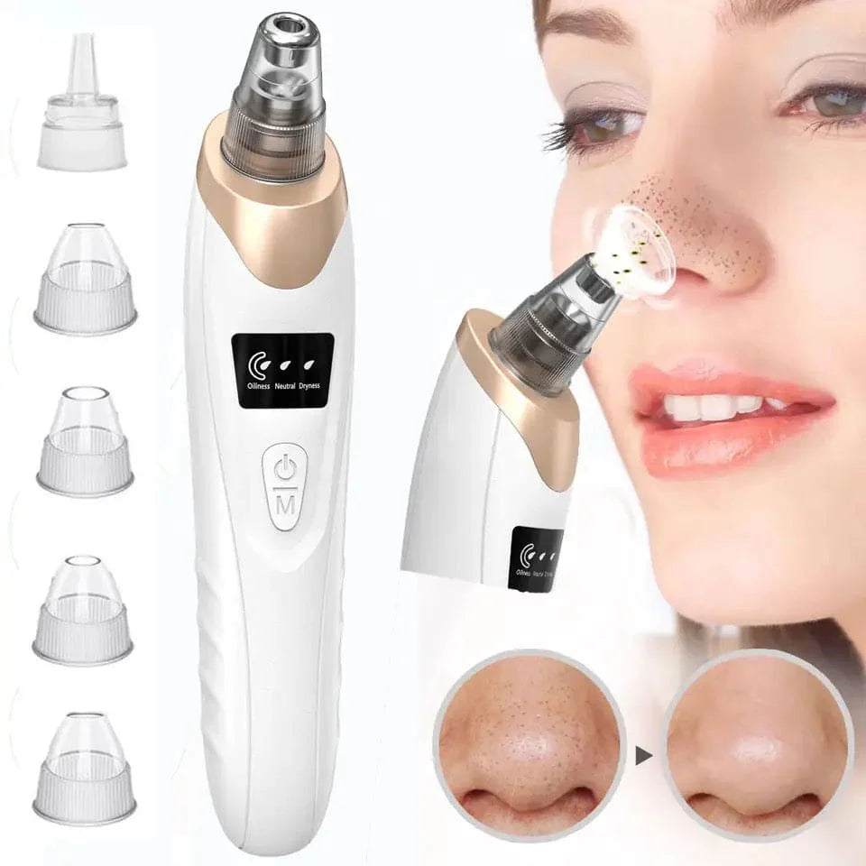 ModeX Blackhead removal Machine